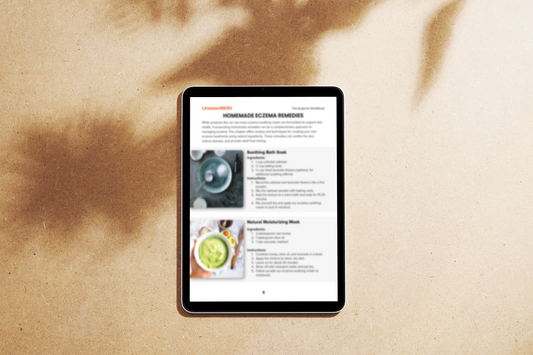 The Eczema Handbook & Recipes E-Book